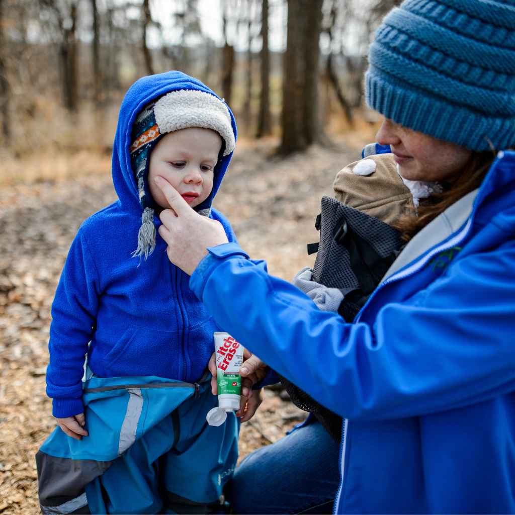 The Itch Eraser Gel using on child's face while hiking in the outdoors