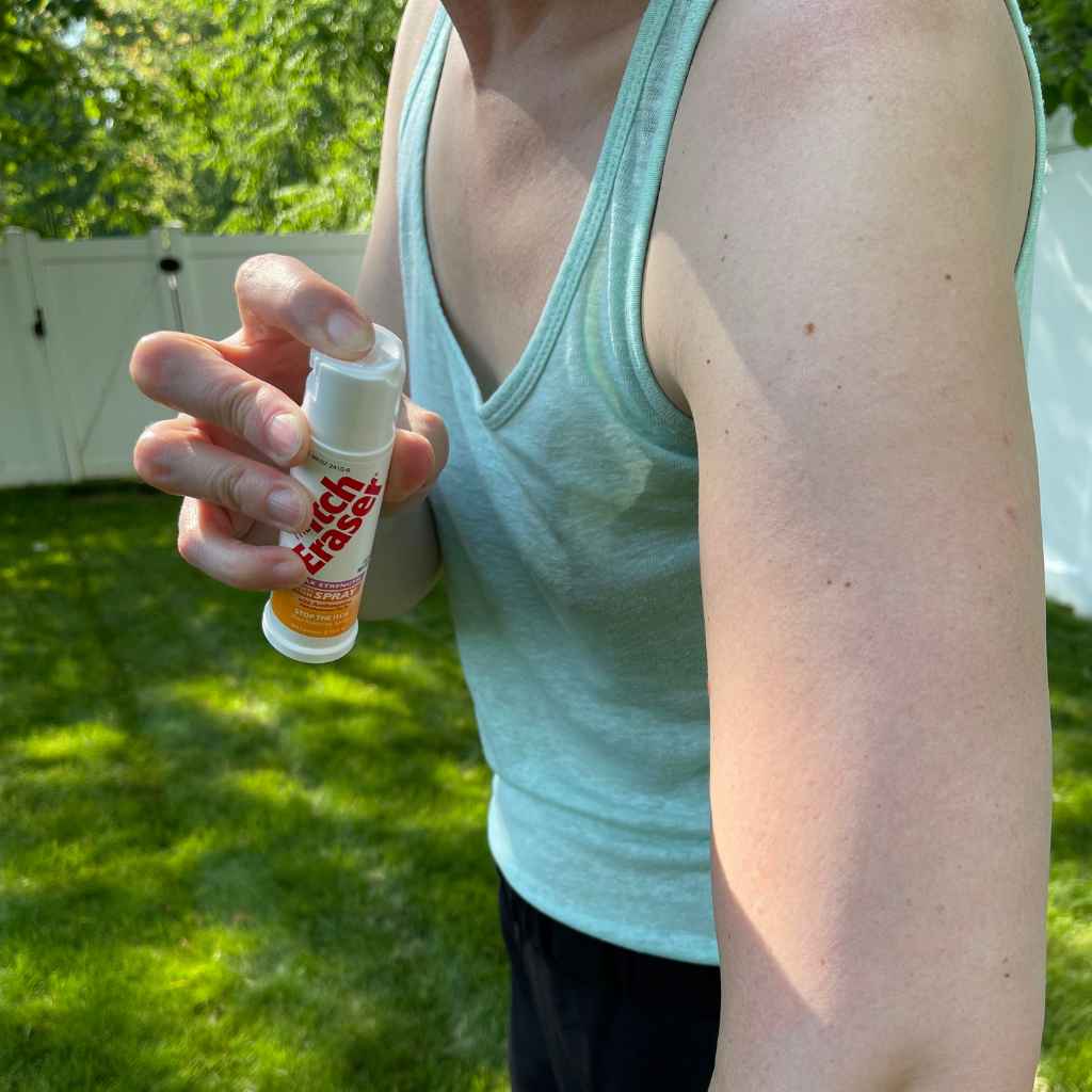 The Itch Eraser Spray person spraying on arm in backyard