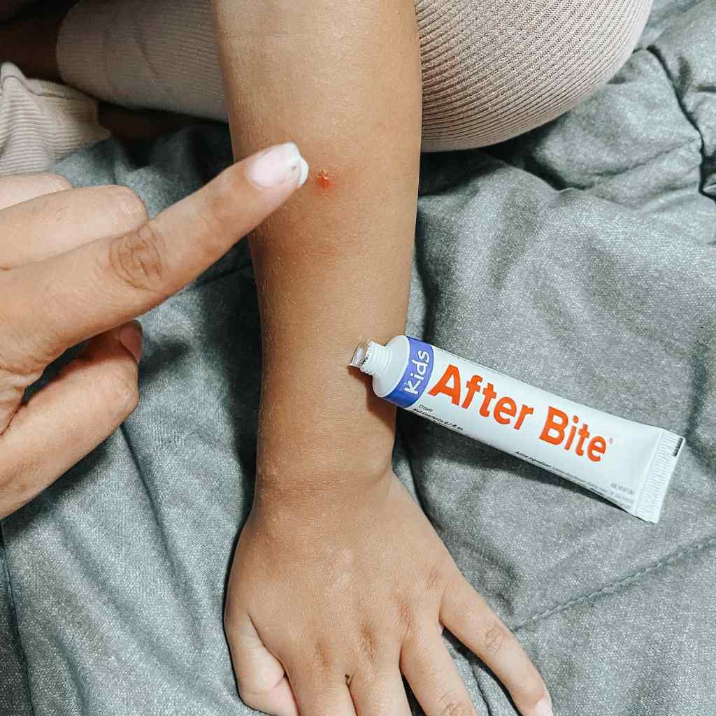 After Bite Kids applying to child's arm